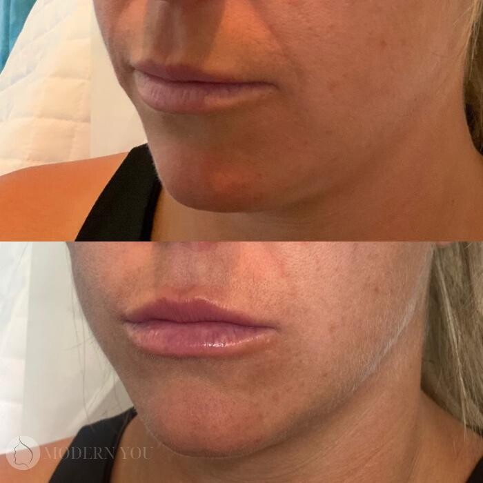 Images Modern You Medical Aesthetics