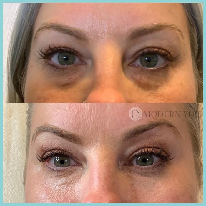 Images Modern You Medical Aesthetics
