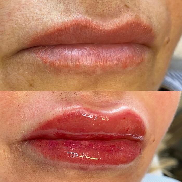 Images Modern You Medical Aesthetics