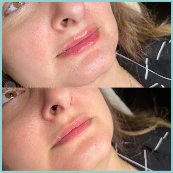 Images Modern You Medical Aesthetics