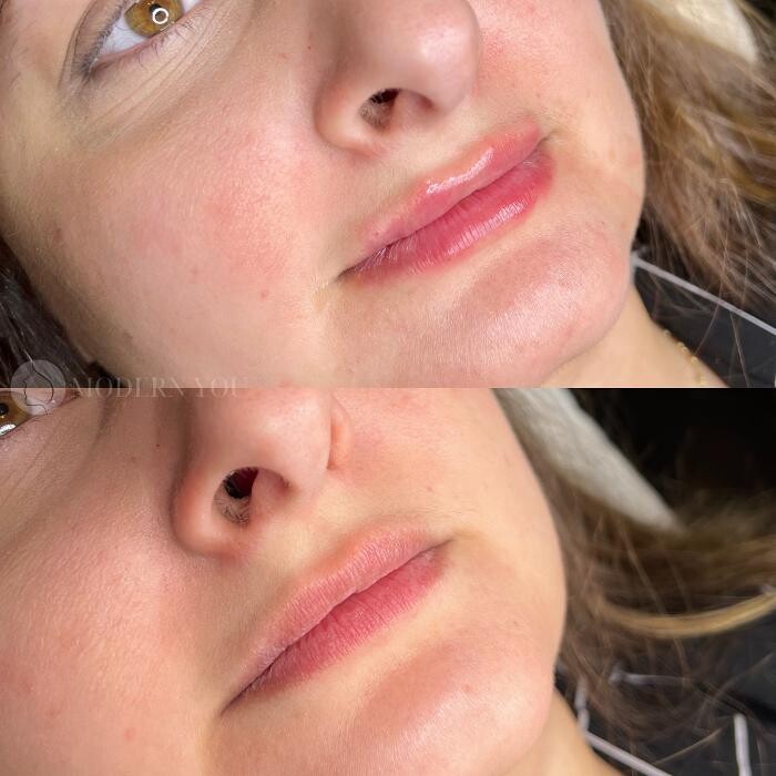 Images Modern You Medical Aesthetics