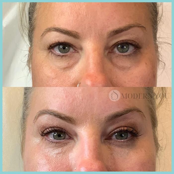 Images Modern You Medical Aesthetics