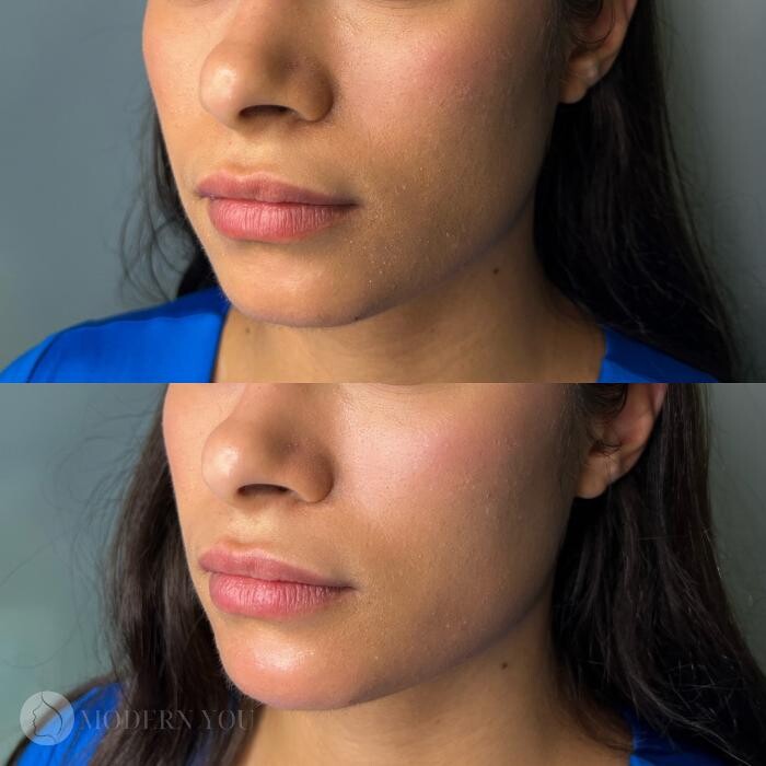 Images Modern You Medical Aesthetics