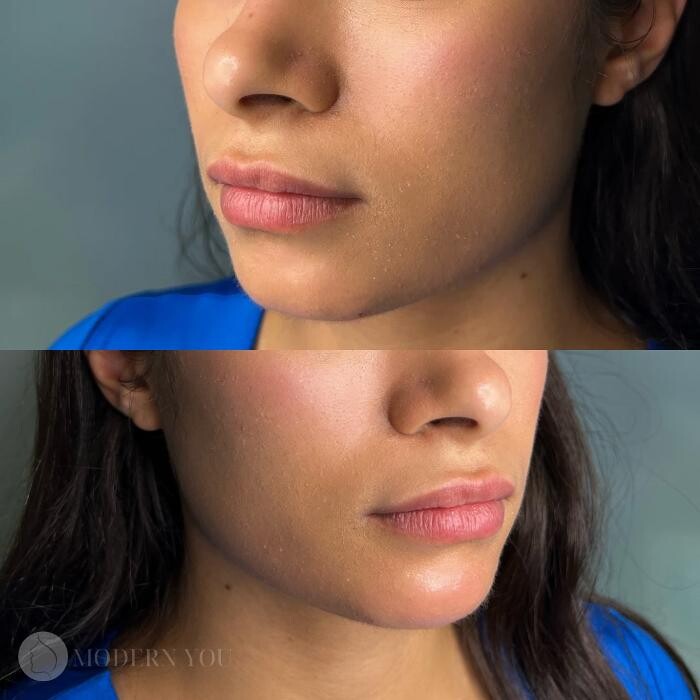 Images Modern You Medical Aesthetics