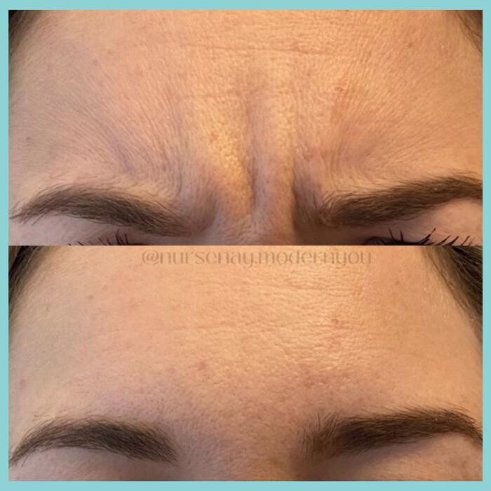 Images Modern You Medical Aesthetics