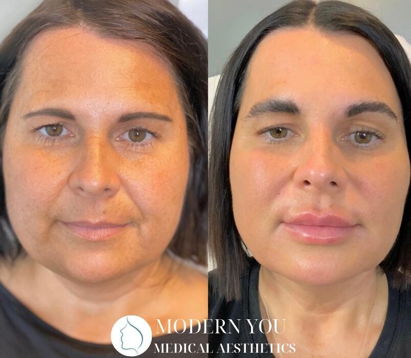 Images Modern You Medical Aesthetics