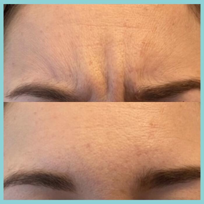 Images Modern You Medical Aesthetics