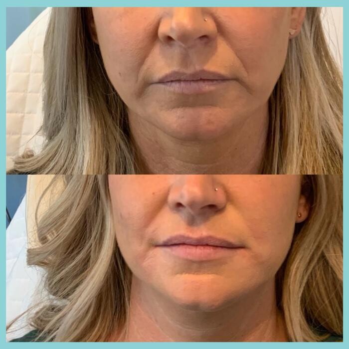 Images Modern You Medical Aesthetics