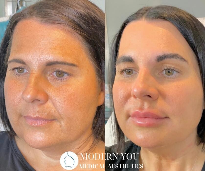 Images Modern You Medical Aesthetics