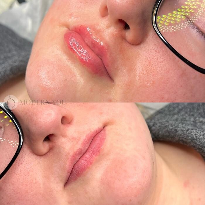 Images Modern You Medical Aesthetics
