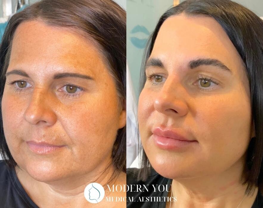 Images Modern You Medical Aesthetics