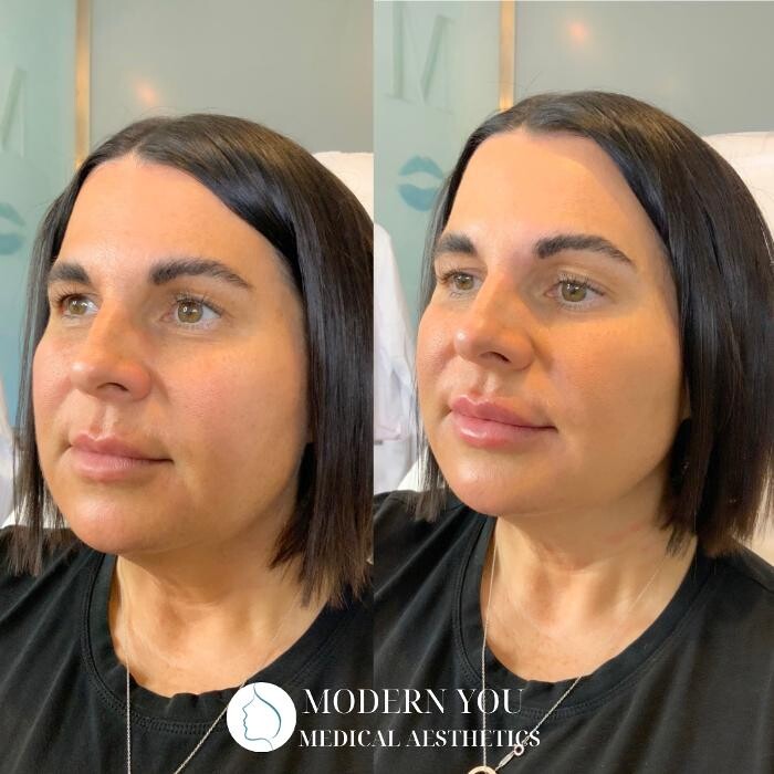 Images Modern You Medical Aesthetics