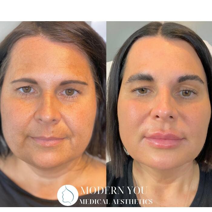 Images Modern You Medical Aesthetics
