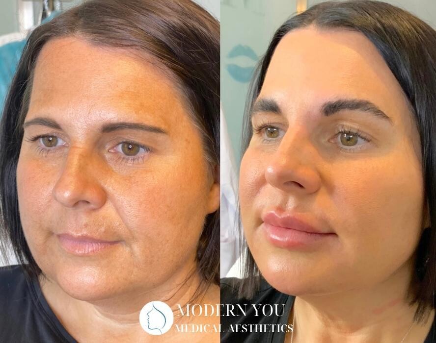 Images Modern You Medical Aesthetics