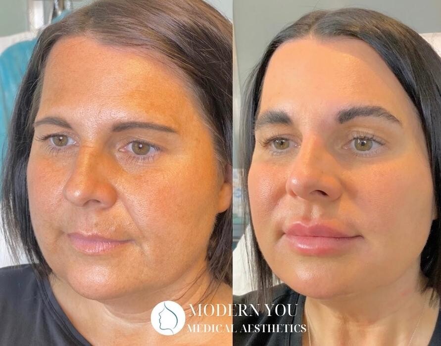 Images Modern You Medical Aesthetics