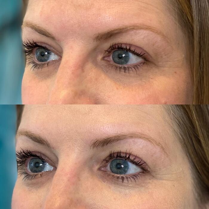 Images Modern You Medical Aesthetics