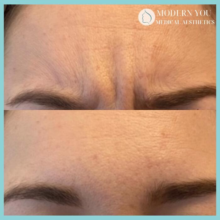 Images Modern You Medical Aesthetics