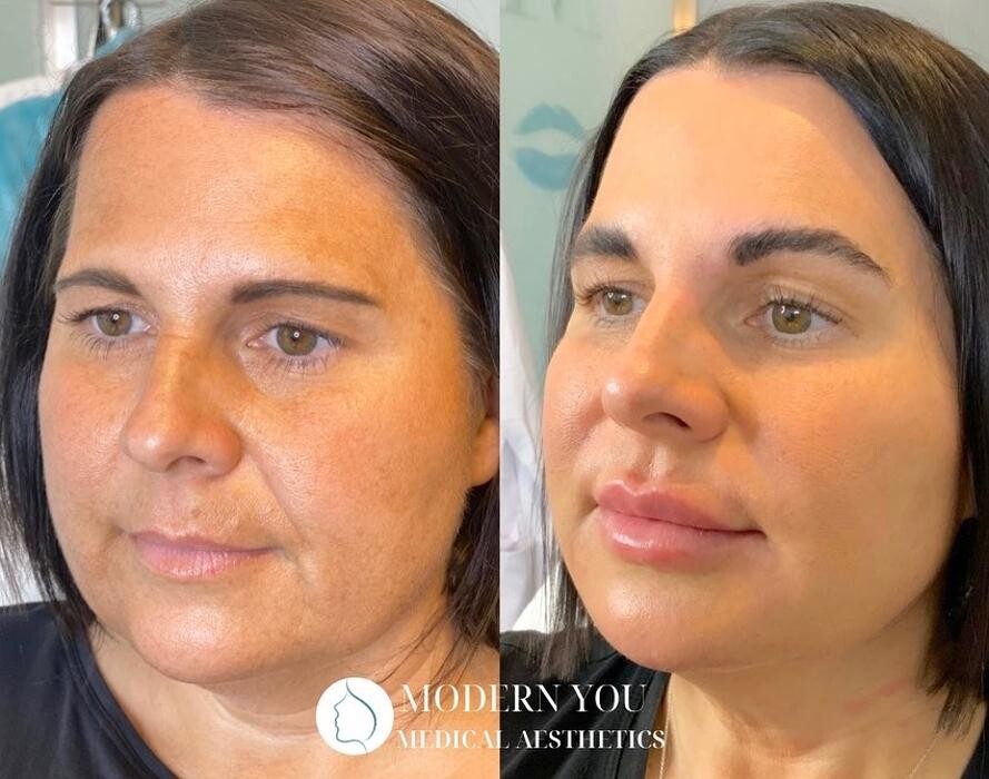 Images Modern You Medical Aesthetics