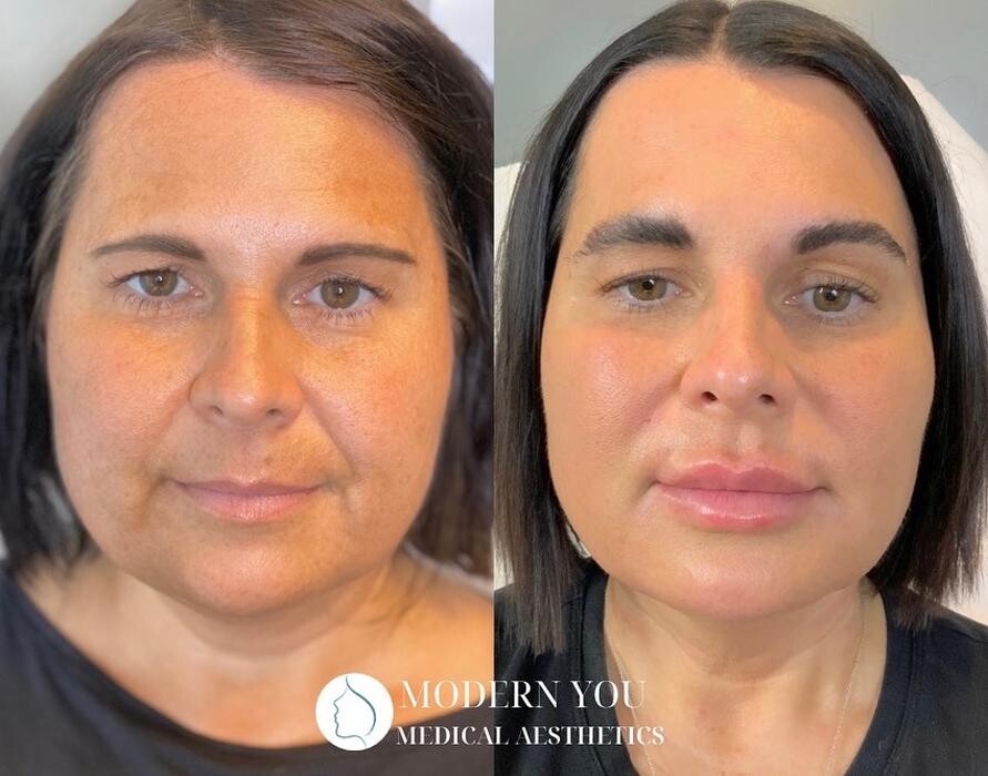 Images Modern You Medical Aesthetics