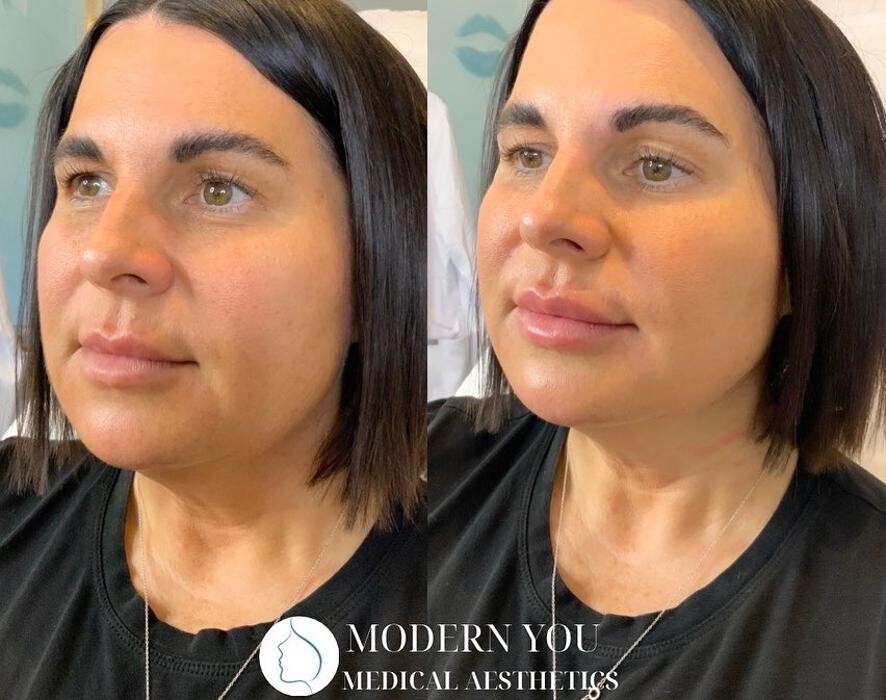 Images Modern You Medical Aesthetics