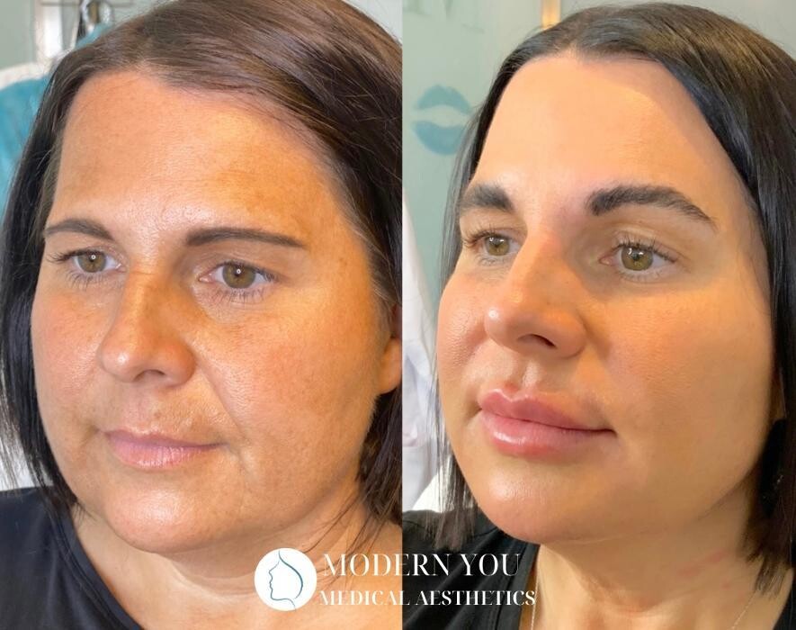 Images Modern You Medical Aesthetics
