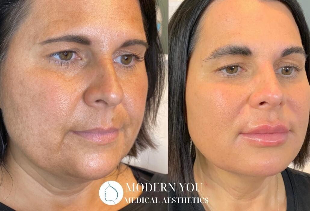 Images Modern You Medical Aesthetics
