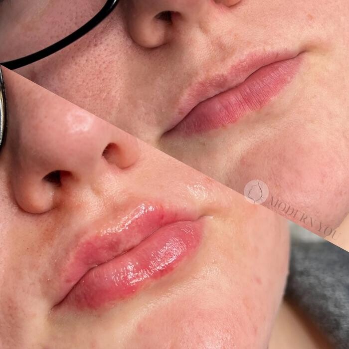 Images Modern You Medical Aesthetics