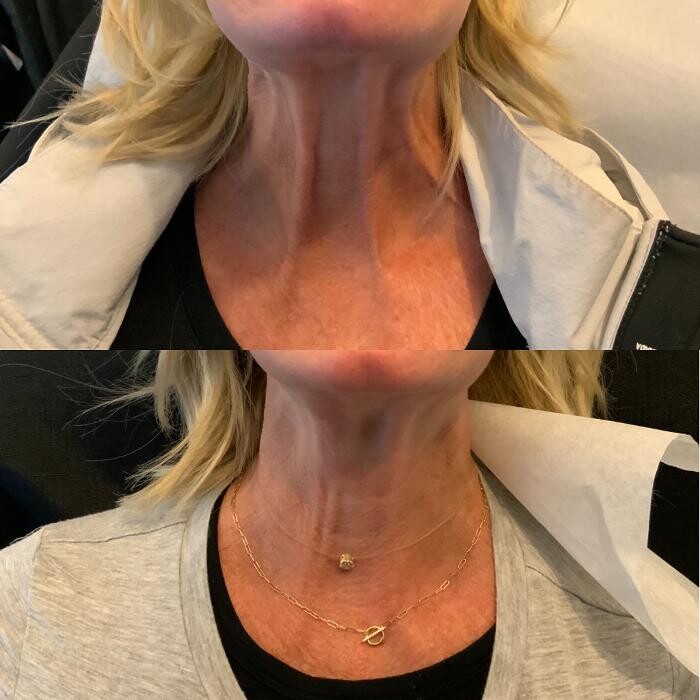 Images Modern You Medical Aesthetics