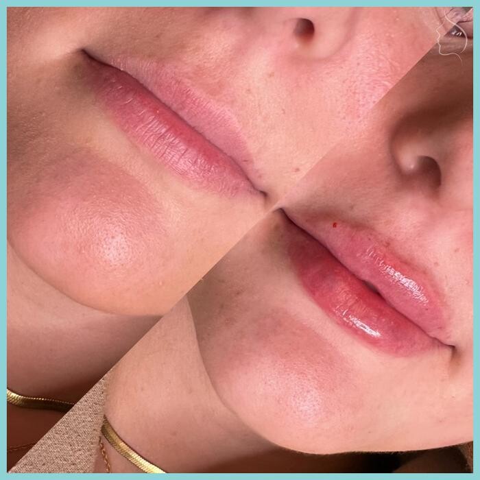 Images Modern You Medical Aesthetics