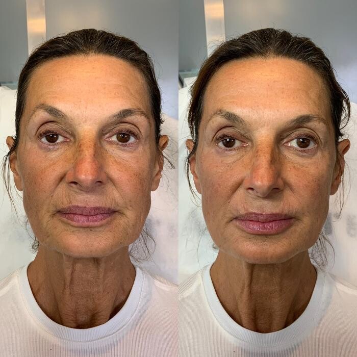 Images Modern You Medical Aesthetics