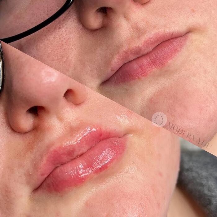 Images Modern You Medical Aesthetics