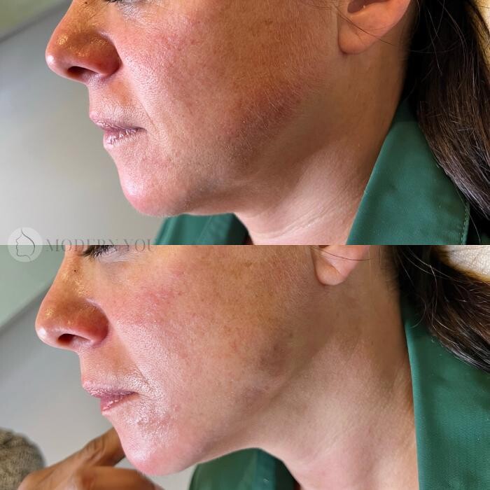 Images Modern You Medical Aesthetics