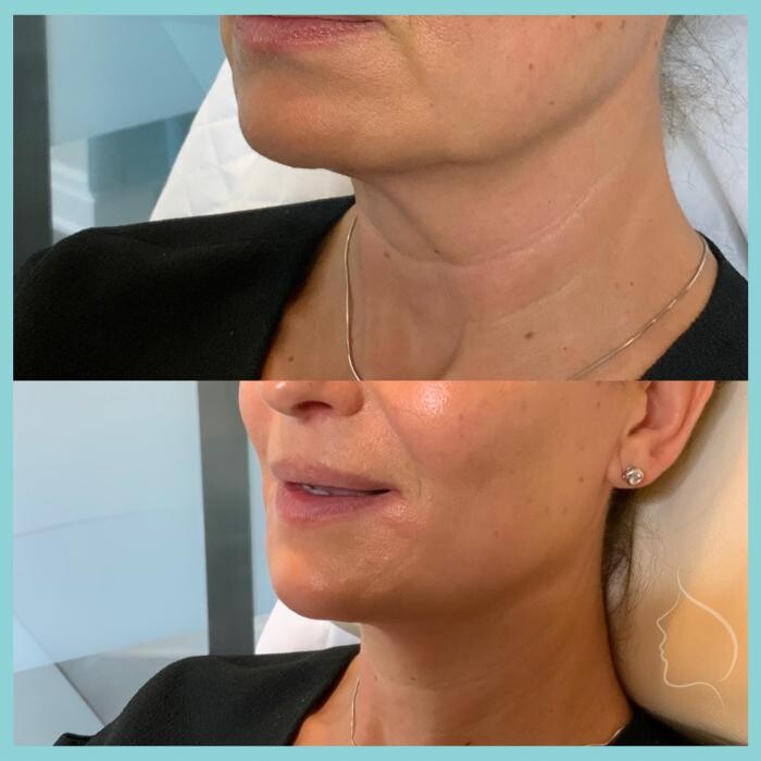 Images Modern You Medical Aesthetics