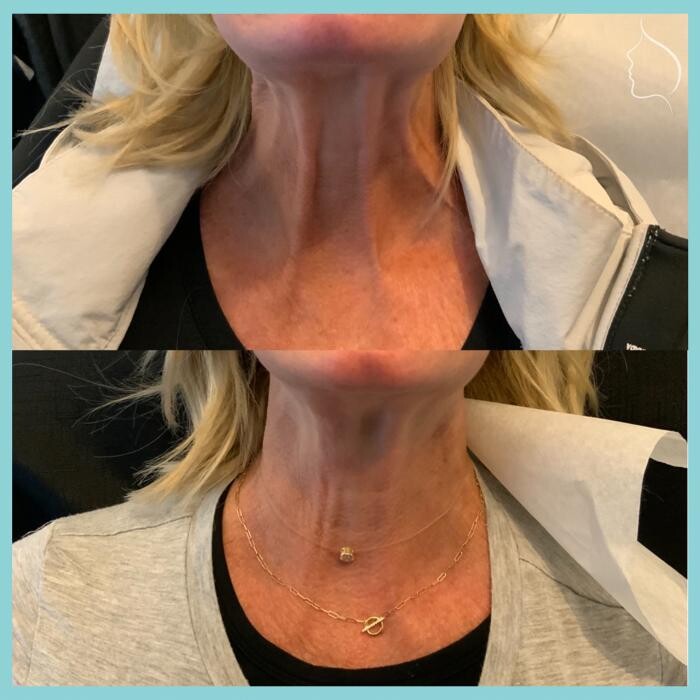 Images Modern You Medical Aesthetics