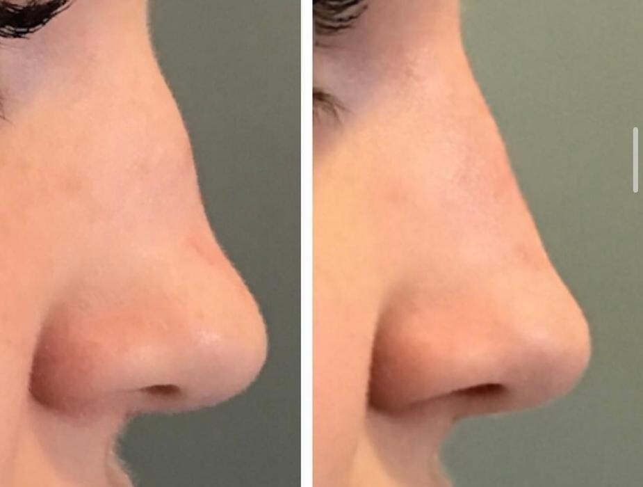 Images Modern You Medical Aesthetics