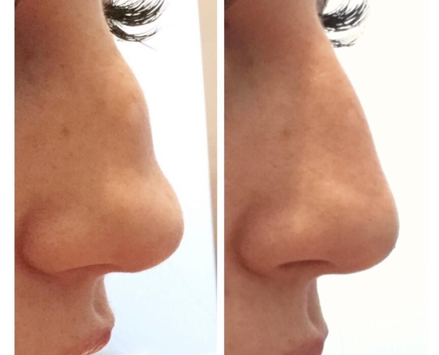 Images Modern You Medical Aesthetics