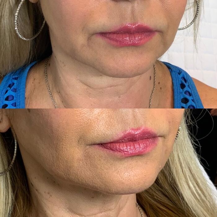 Images Modern You Medical Aesthetics