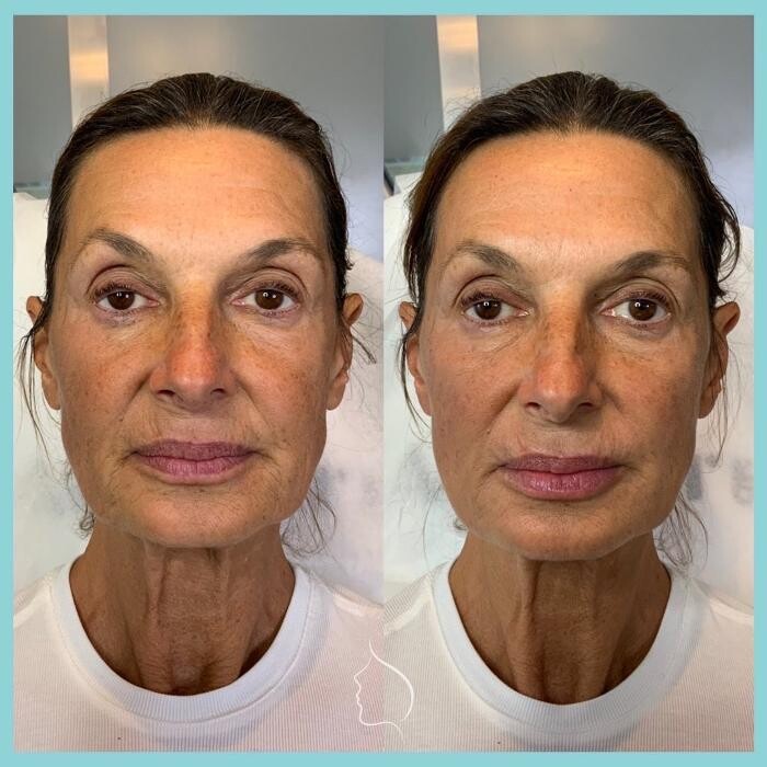 Images Modern You Medical Aesthetics