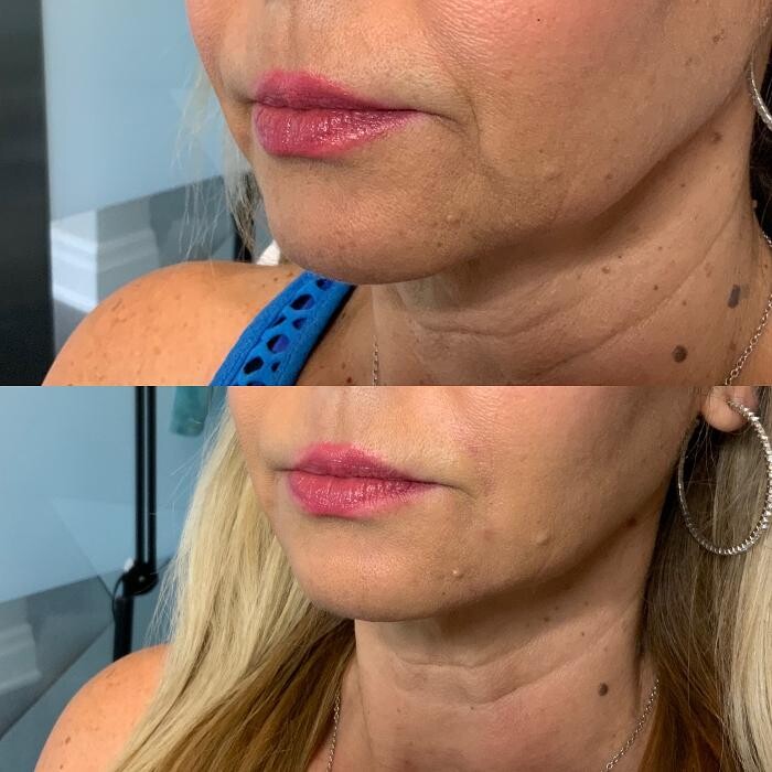 Images Modern You Medical Aesthetics