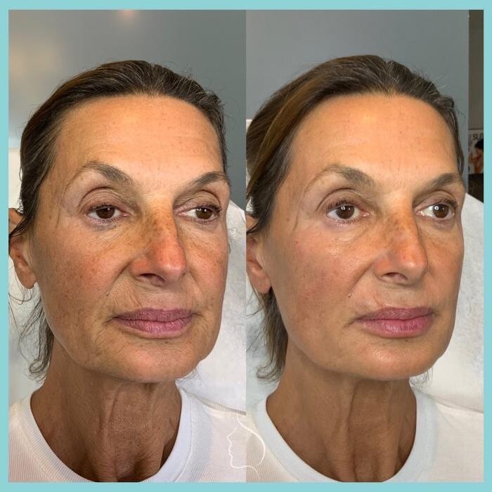 Images Modern You Medical Aesthetics