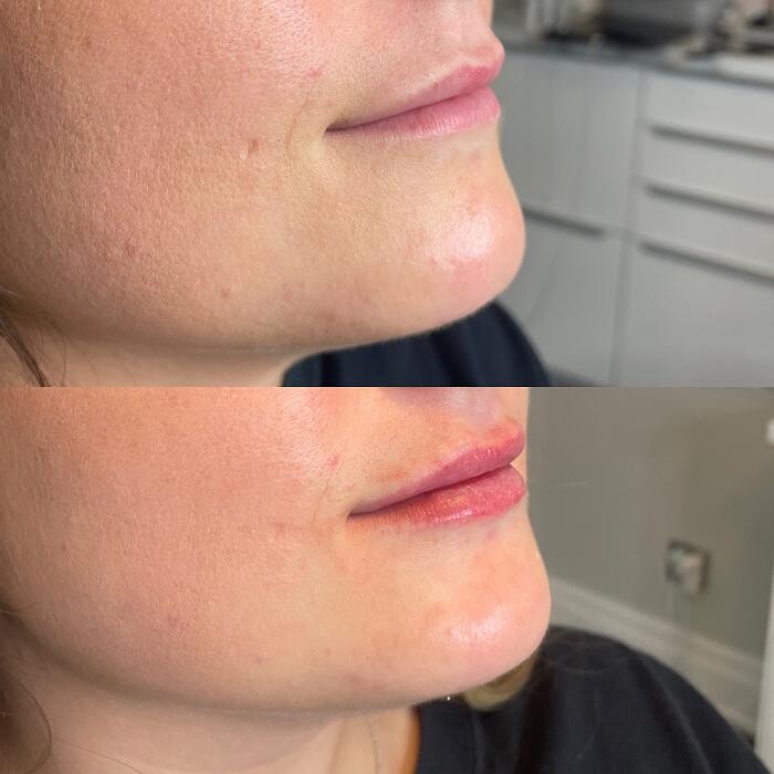 Images Modern You Medical Aesthetics