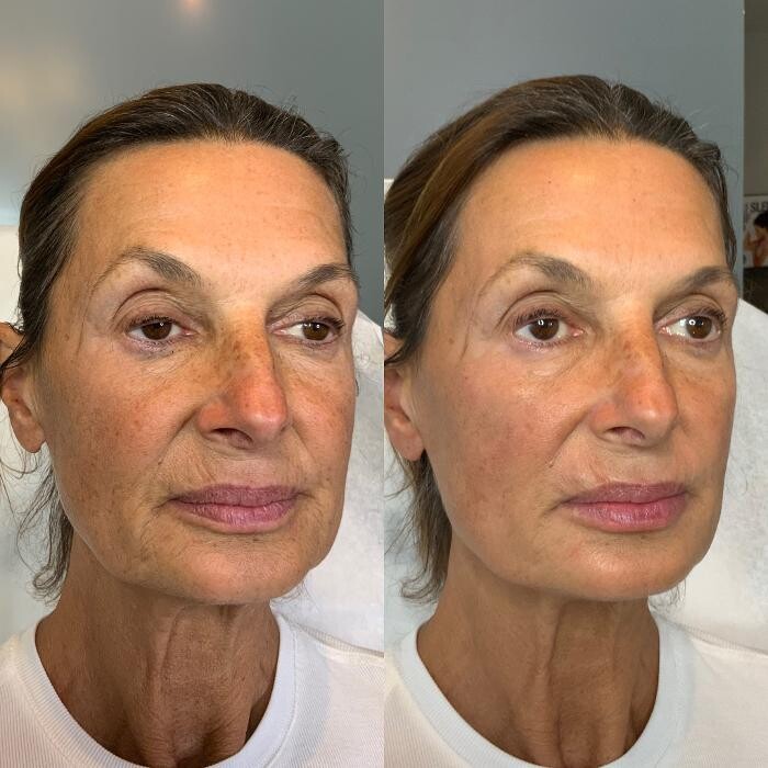 Images Modern You Medical Aesthetics