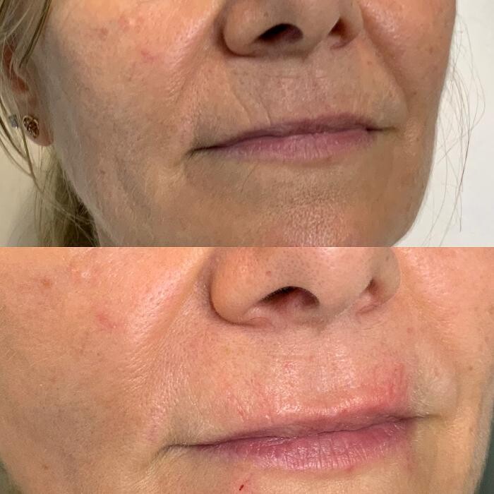 Images Modern You Medical Aesthetics