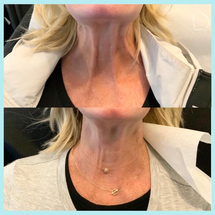 Images Modern You Medical Aesthetics