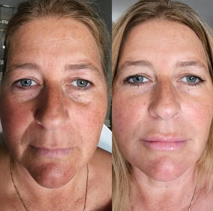 Images Modern You Medical Aesthetics