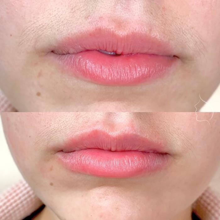 Images Modern You Medical Aesthetics