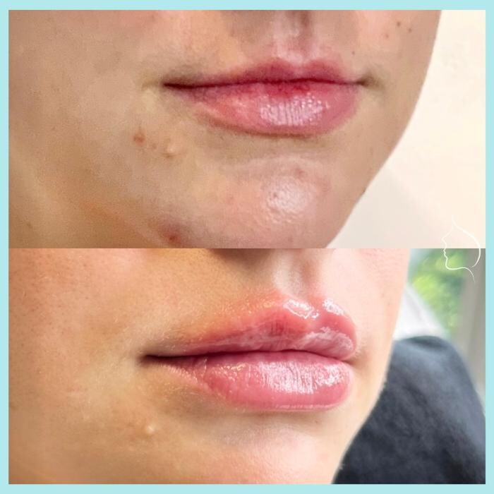Images Modern You Medical Aesthetics