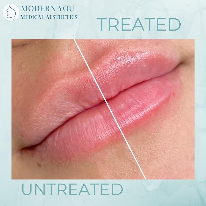Images Modern You Medical Aesthetics