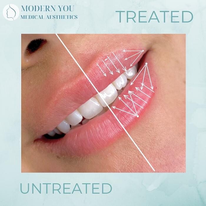Images Modern You Medical Aesthetics