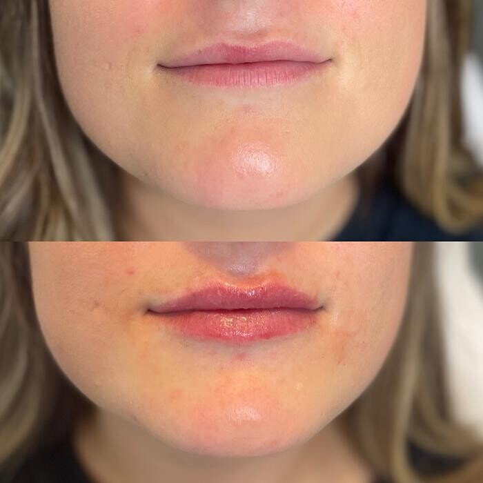 Images Modern You Medical Aesthetics